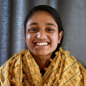 तेजाबले अनुहार जलाएपनि सपना जलेको छैन